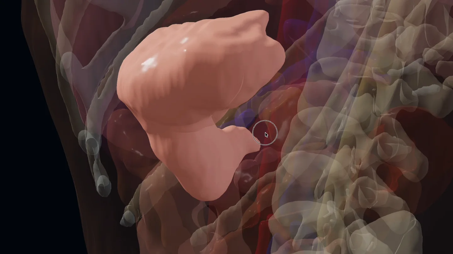 A stomach reconstructed in Body4D, with surrounding anatomy shown transparently